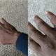 Image for article titled It’s Not About the Band-Aids
